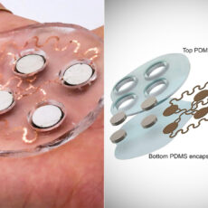 cUSP Ultrasonic Wearable Patch Deliver Drugs Skin